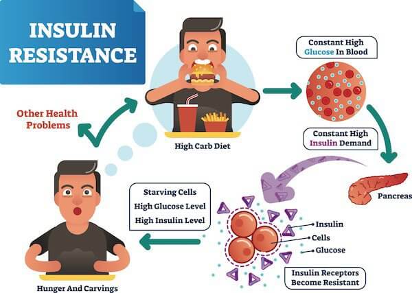 Insulin Resistance (Natural-Medicine)