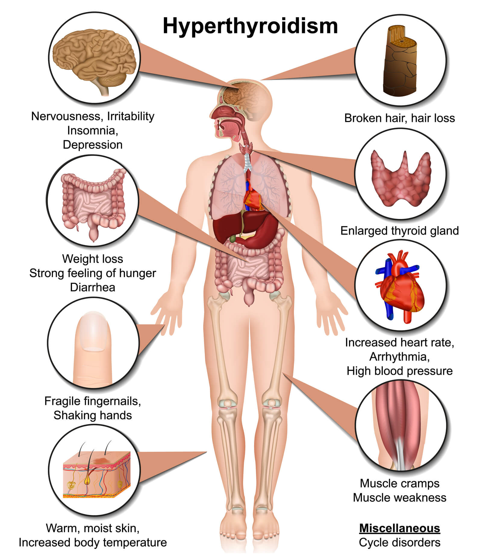 Are Your Hormones Imbalanced?(Natural-Medicine)